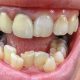 6 80x80 - دندانپزشکی شبانه روزی در کرج