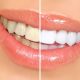 4 1 80x80 - زرد شدن دندان و روش درمان آن