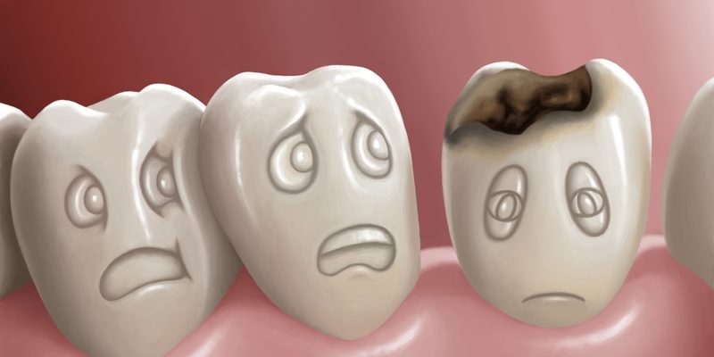 پوسیدگی و حفره های دندانی