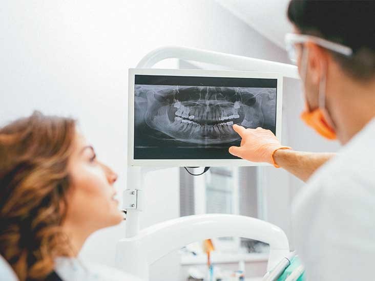 آشنایی با انواع تصاویر رادیوگرافی دندانپزشکی - کلینیک دندانپزشکی بیهوشی  مهرویلا در کرج
