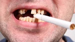 سیگار و سلامت دهان و دندان