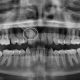 15 80x80 - لق شدن دندان در بزرگسالان