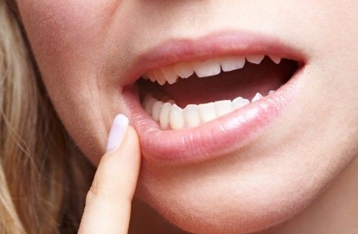 لق شدن دندان ها در افراد بزرگسال