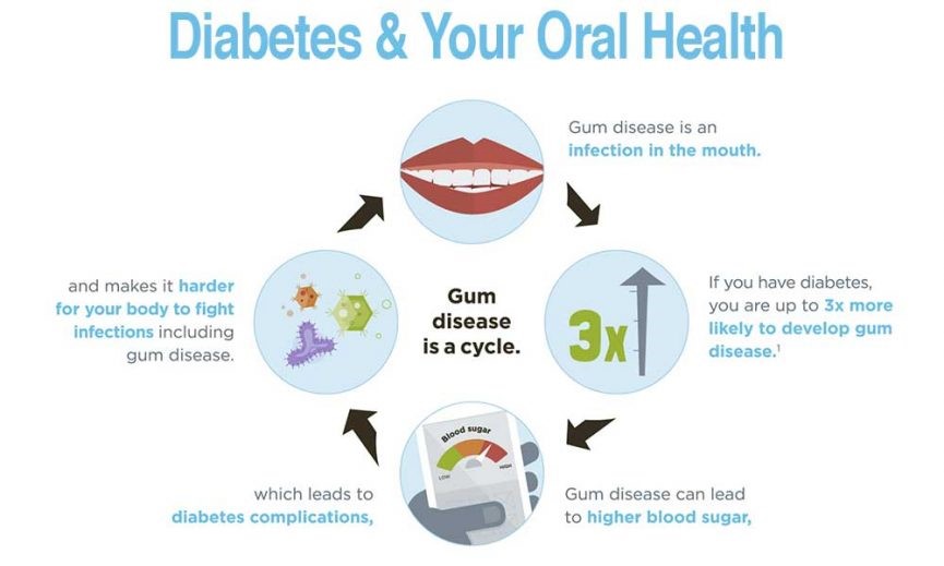 دیابت و سلامت دهان و دندان ها