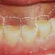 15 80x80 - مراقبت های دهان و دندان در طول دوران بارداری