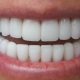 8 80x80 - آیا ایمپلنت ها بهتر از دندان های طبیعی هستند؟