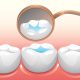 9 80x80 - چه زمانی کشیدن دندان برای ارتودنسی لازم است؟