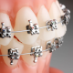 9 80x80 - آیا اسید فیتیک برای سلامت دهان و دندان ها خوب است؟