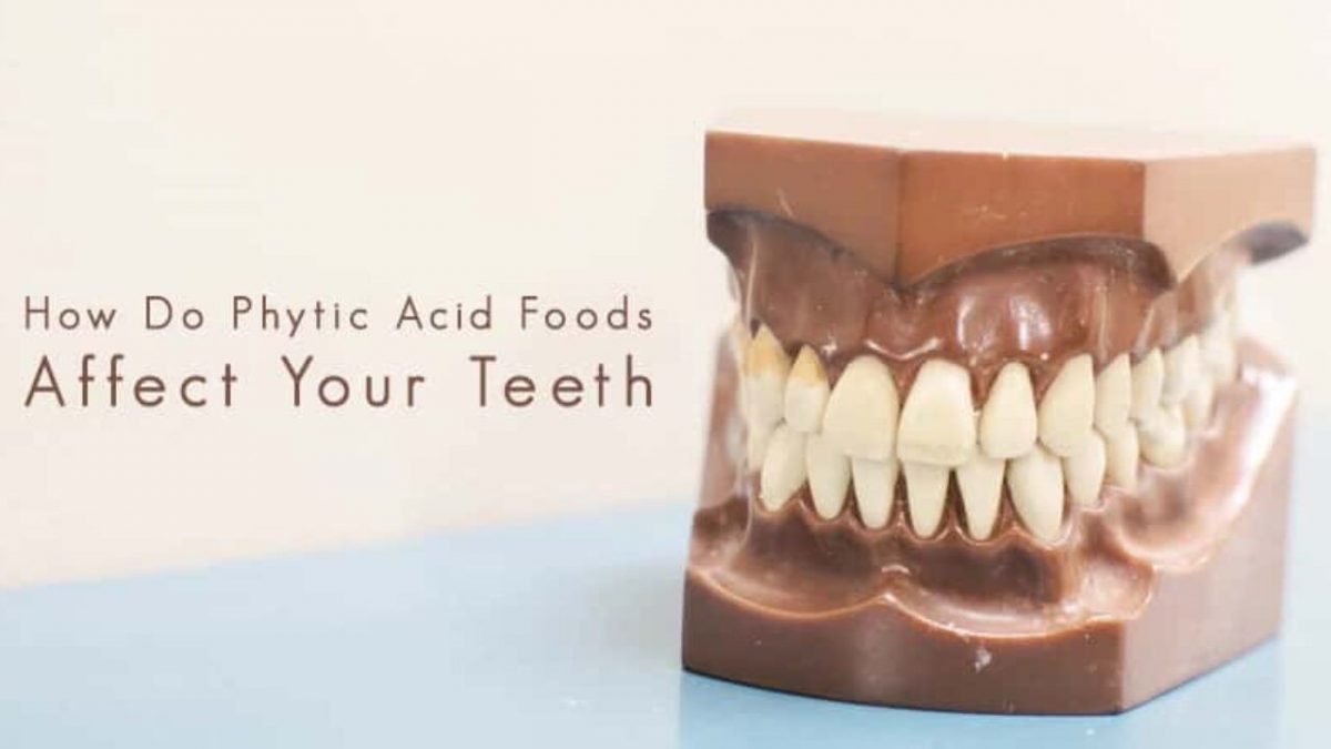 13 1200x675 - آیا اسید فیتیک برای سلامت دهان و دندان ها خوب است؟