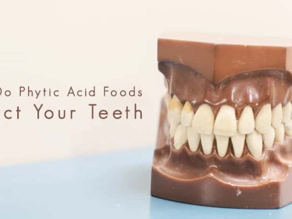 13 960x720 - آیا اسید فیتیک برای سلامت دهان و دندان ها خوب است؟