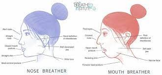 تنفس دهانی و درمان آن