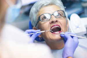 19 - آنتی بیوتیک ها برای درمان های دندانی بعد از تعویض مفصل فک