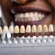 14 80x80 - آیا در طول درمان ارتودنسی باید به دندانپزشک مراجعه کرد؟