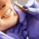 30 80x80 - میکروابریژن مینای دندان چیست و چه کاربردی دارد؟