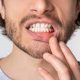 10 80x80 - باکتری های پلاک چگونه باعث بیماری لثه و پوسیدگی دندان می شوند؟
