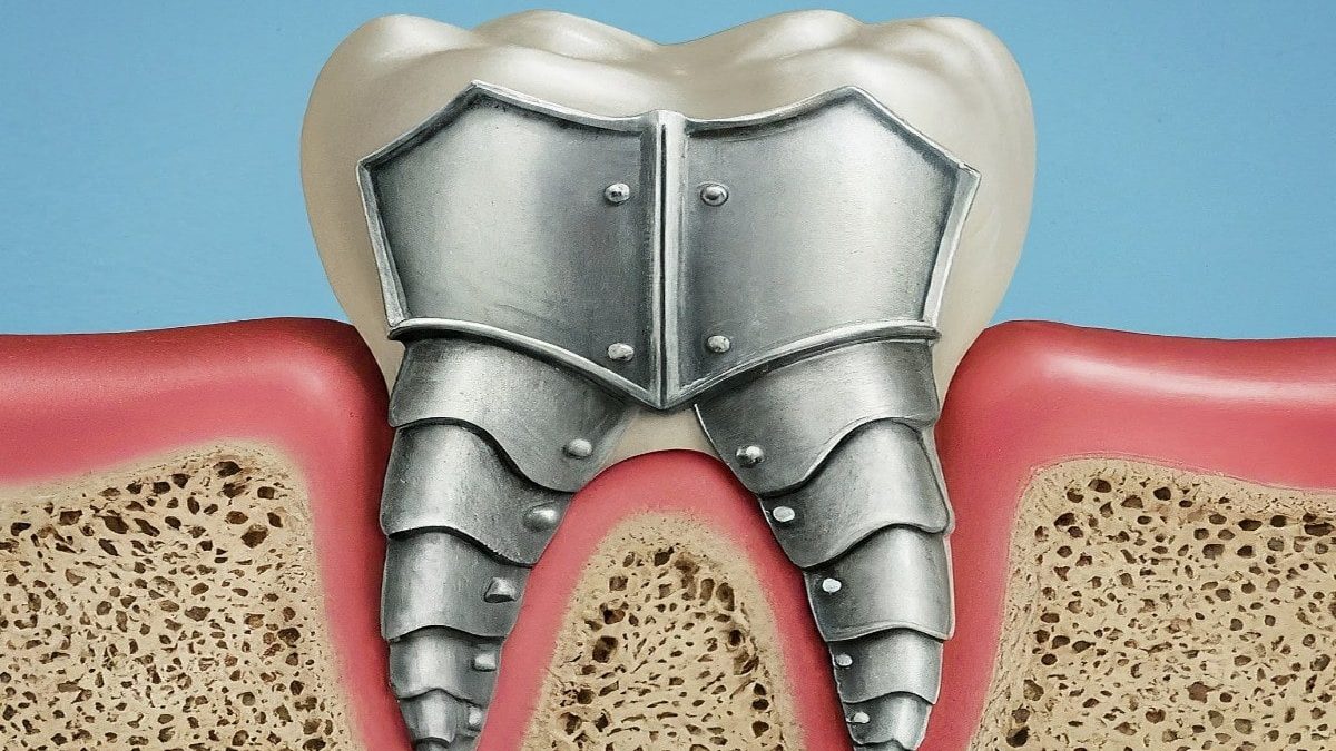 0 min 1200x675 - آیا می توان دندان های تضعیف شده را تقویت کرد؟