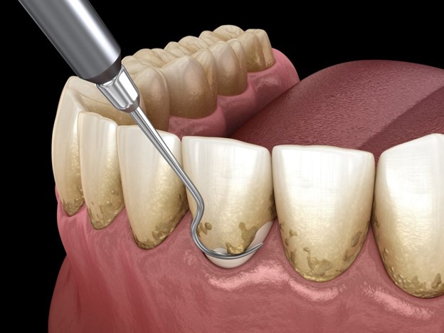 مزایای بالقوه این درمان کدامند؟