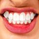 0 80x80 - کمبود چه ویتامین هایی باعث خونریزی لثه می شود؟
