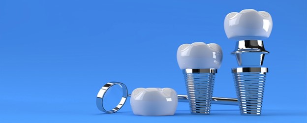سایر علل پس زده شدن ایمپلنت های دندانی